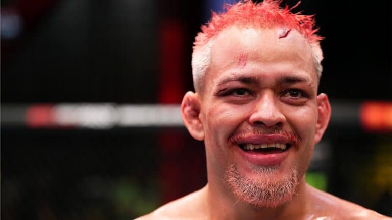 Elves Brener: “Anak Amazon” Dari Maués